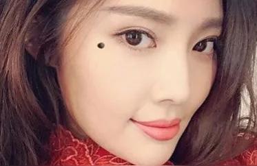 脸上胎记的位置与命运痣长在脸上的含义