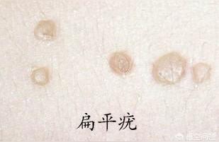 肚脐上长猴子算命学-长不胖是什么原因