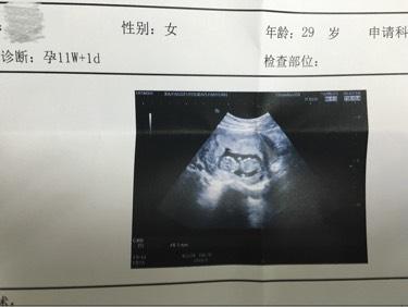 起名大全：姓周的男孩名字-妈妈姓李怎么取名