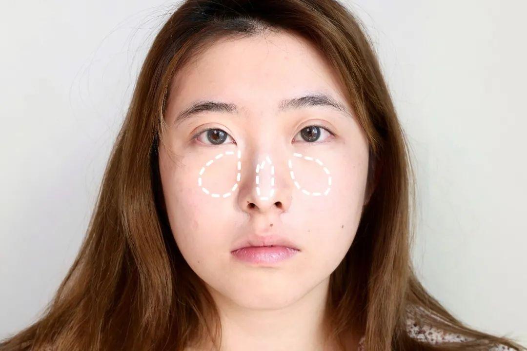 蒜头鼻算命鼻翼小鼻头大是什么鼻型