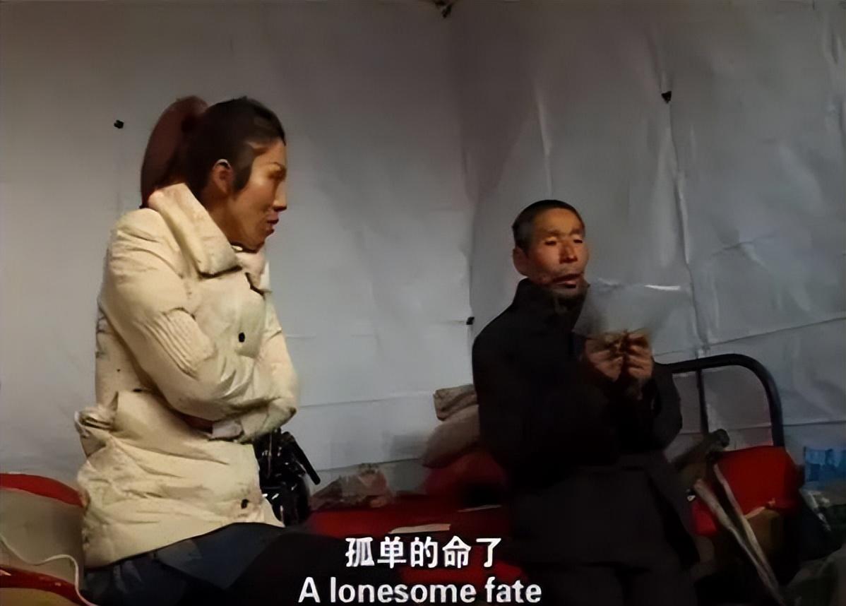 肚脐下有一根毛算命-人为什么会长痣