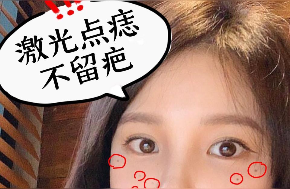 算命脸上痦子-面无善痣是什么意思